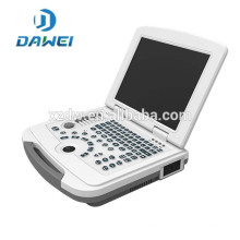 DW-500 Preis Laptop Ultraschallgeräte aus China